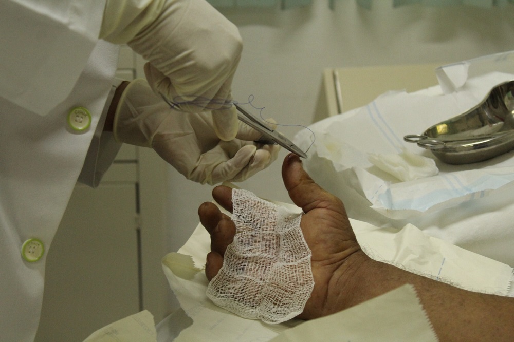 Atender heridas a tiempo es clave para prevenir miasis por gusano barrenador, alerta Salud Colima